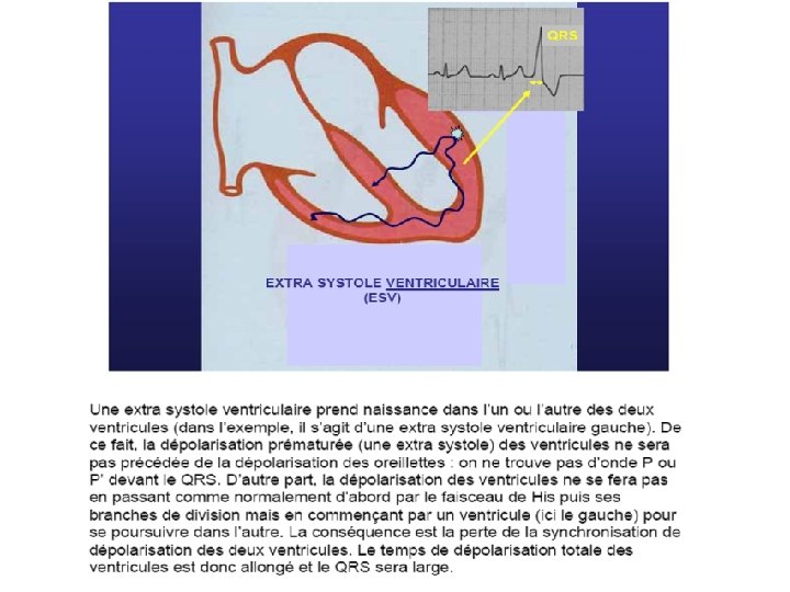 Les troubles du rythme § Intervalle PR temps de conduction auriculo-ventriculaire compris entre 0,