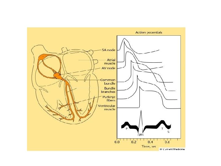 Les troubles du rythme cardiaques : Schéma 2 