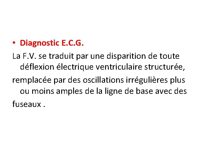  • Diagnostic E. C. G. La F. V. se traduit par une disparition