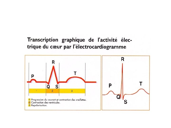 Les troubles du rythme cardiaques : Schéma 3 