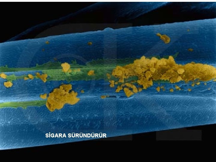 SİGARA SÜRÜNDÜRÜR 