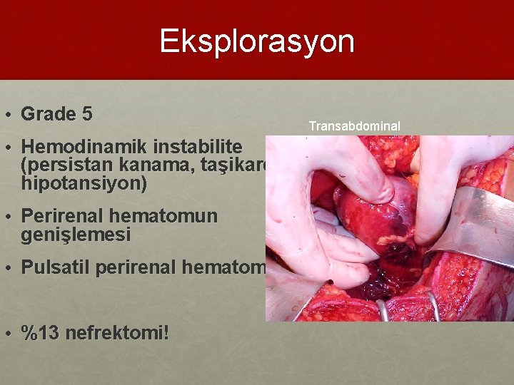 Eksplorasyon • Grade 5 • Hemodinamik instabilite (persistan kanama, taşikardi, hipotansiyon) • Perirenal hematomun