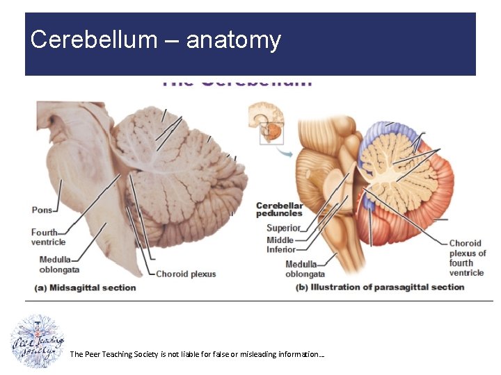 Cerebellum – anatomy The Peer Teaching Society is not liable for false or misleading