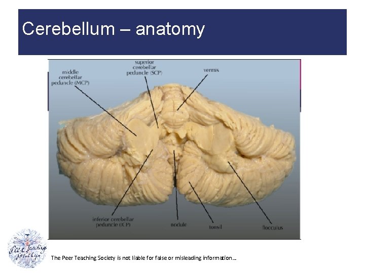 Cerebellum – anatomy The Peer Teaching Society is not liable for false or misleading