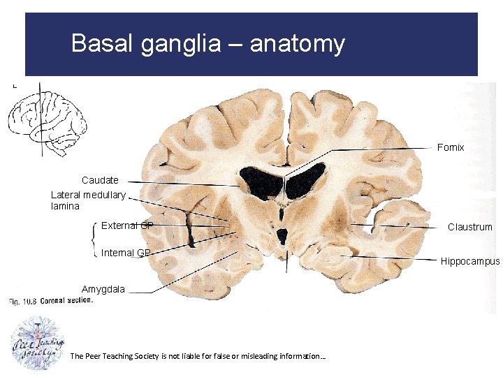 Basal ganglia – anatomy Fornix Caudate Lateral medullary lamina External GP Internal GP Amygdala