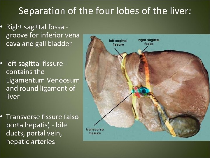 Separation of the four lobes of the liver: • Right sagittal fossa groove for