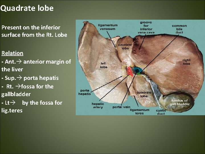 Quadrate lobe Present on the inferior surface from the Rt. Lobe Relation - Ant.