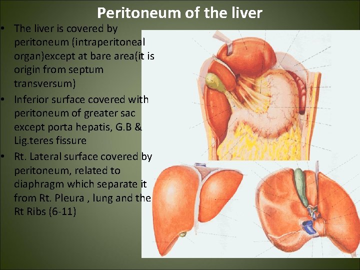 Peritoneum of the liver • The liver is covered by peritoneum (intraperitoneal organ)except at