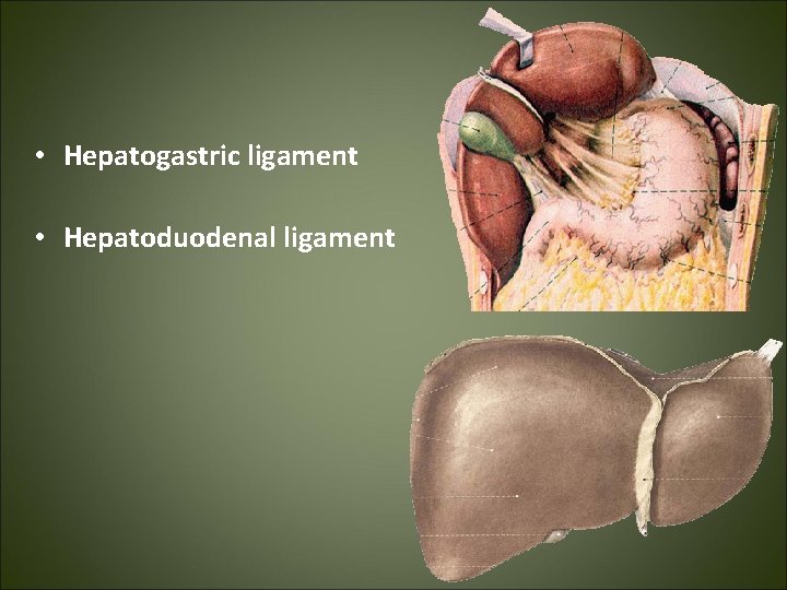 • Hepatogastric ligament • Hepatoduodenal ligament 