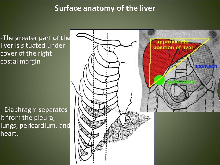 Surface anatomy of the liver -The greater part of the liver is situated under