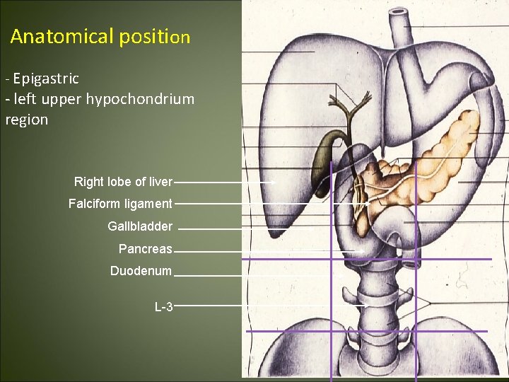 Anatomical position - Epigastric - left upper hypochondrium region Right lobe of liver Falciform