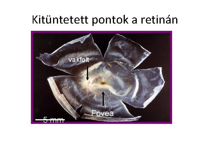 Kitüntetett pontok a retinán vakfolt 5 mm Fovea 