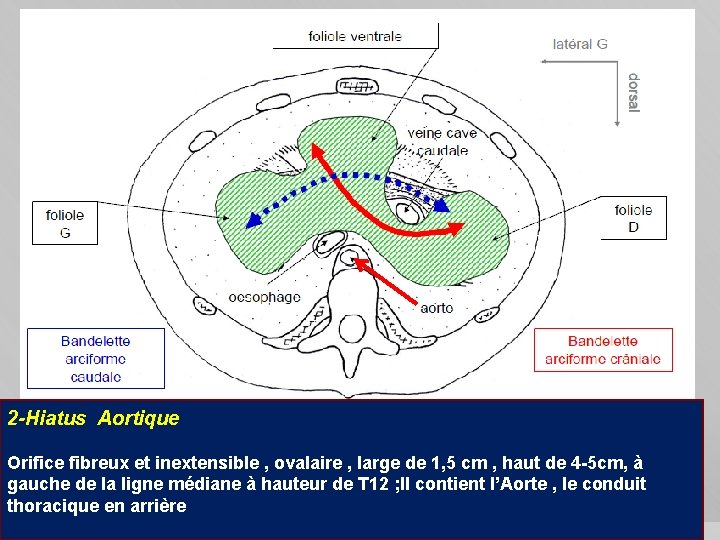 2 -Hiatus Aortique Orifice fibreux et inextensible , ovalaire , large de 1, 5
