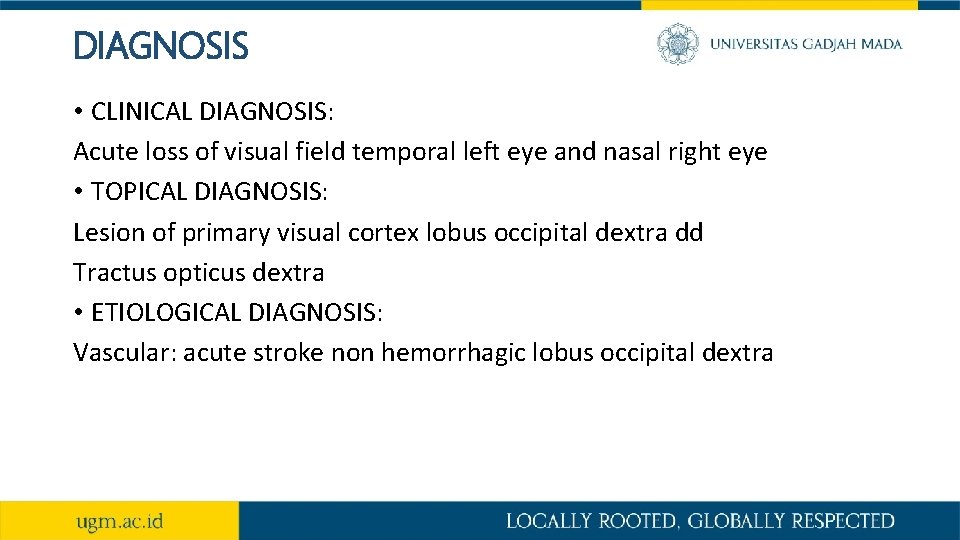 DIAGNOSIS • CLINICAL DIAGNOSIS: Acute loss of visual field temporal left eye and nasal