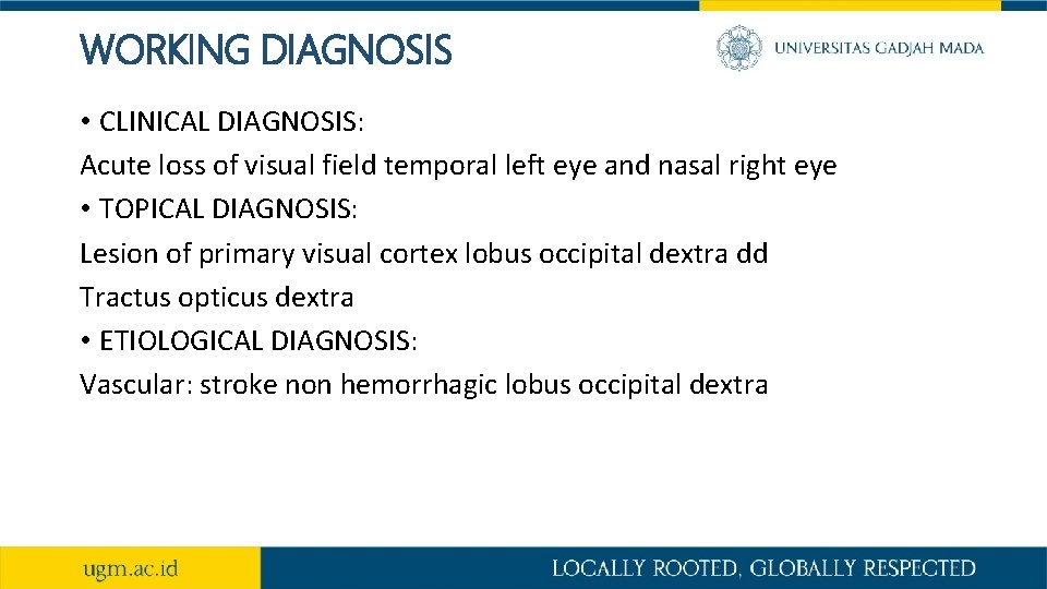 WORKING DIAGNOSIS • CLINICAL DIAGNOSIS: Acute loss of visual field temporal left eye and