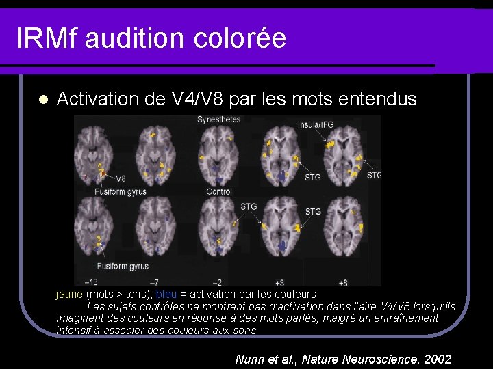 IRMf audition colorée l Activation de V 4/V 8 par les mots entendus jaune