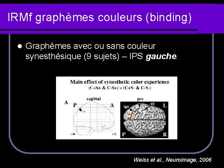 IRMf graphèmes couleurs (binding) l Graphèmes avec ou sans couleur synesthésique (9 sujets) –