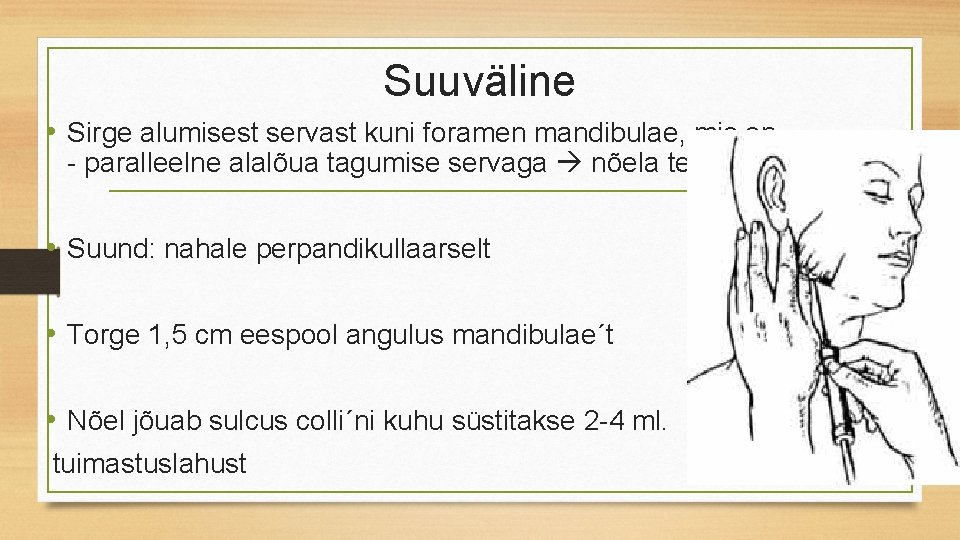 Suuväline • Sirge alumisest servast kuni foramen mandibulae, mis on - paralleelne alalõua tagumise