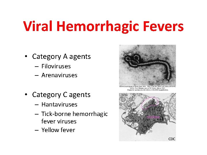 Viral Hemorrhagic Fevers • Category A agents – Filoviruses – Arenaviruses • Category C