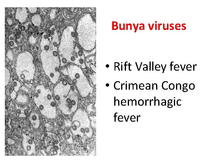 Bunya viruses • Rift Valley fever • Crimean Congo hemorrhagic fever 