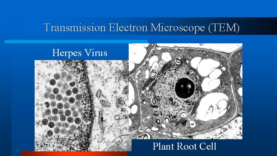 Transmission Electron Microscope (TEM) Herpes Virus Plant Root Cell Transmission Electron Microscope (TEM) Herpes Virus Plant Root Cell