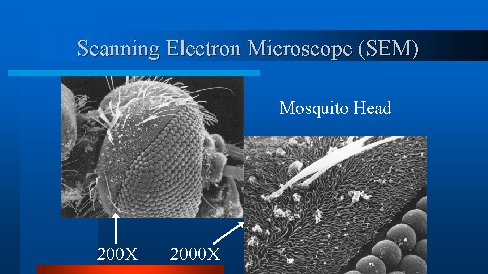 Scanning Electron Microscope (SEM) Mosquito Head 200 X 2000 X Scanning Electron Microscope (SEM) Mosquito Head 200 X 2000 X