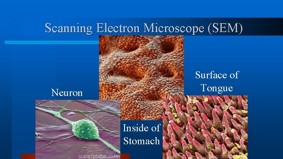 Scanning Electron Microscope (SEM) Surface of Tongue Neuron Inside of Stomach Scanning Electron Microscope (SEM) Surface of Tongue Neuron Inside of Stomach