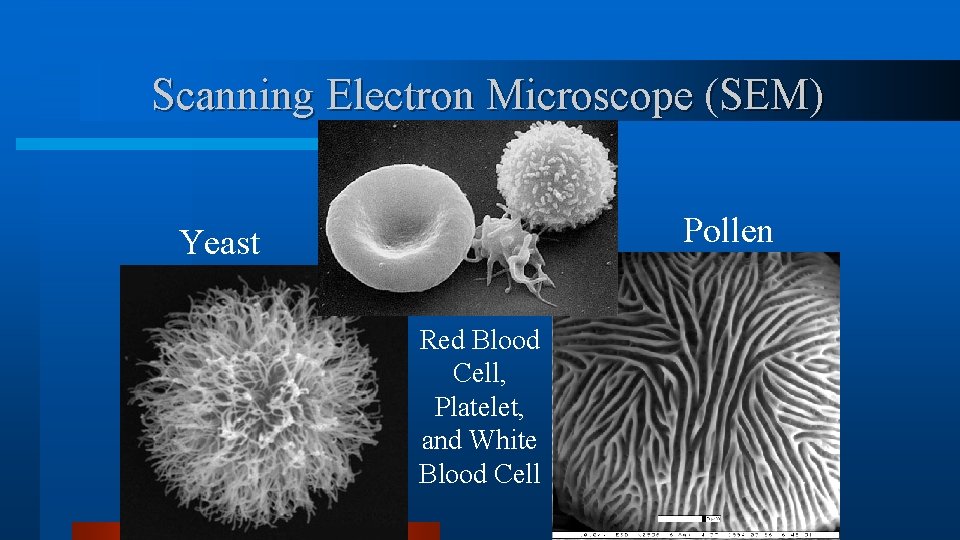 Scanning Electron Microscope (SEM) Pollen Yeast Red Blood Cell, Platelet, and White Blood Cell Scanning Electron Microscope (SEM) Pollen Yeast Red Blood Cell, Platelet, and White Blood Cell