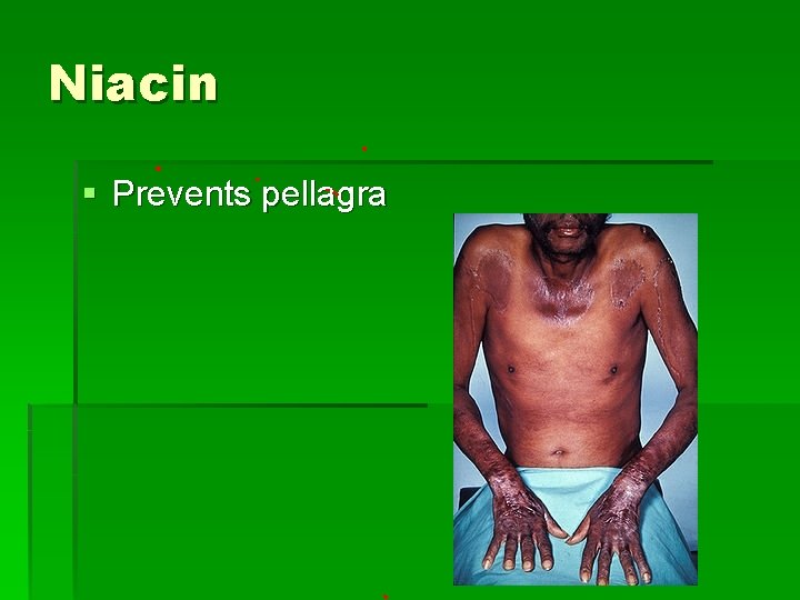 Niacin § Prevents pellagra 