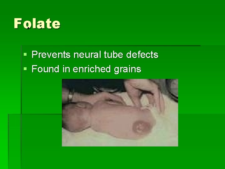 Folate § Prevents neural tube defects § Found in enriched grains 