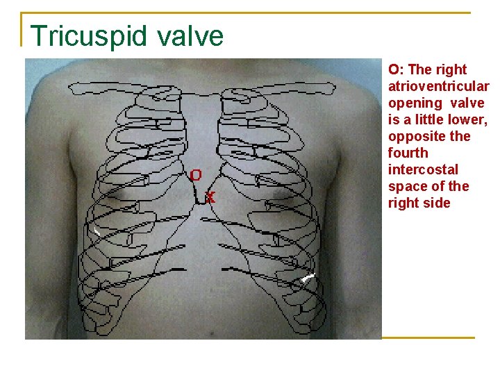 Tricuspid valve O: The right atrioventricular opening valve is a little lower, opposite the