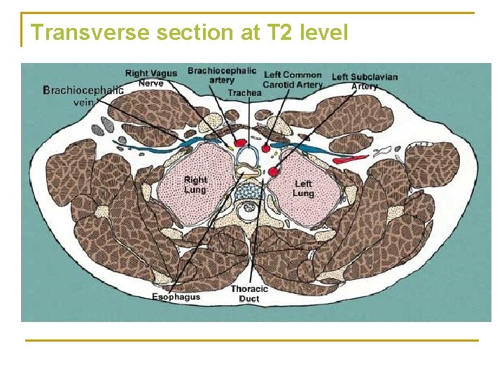 Transverse section at T 2 level 