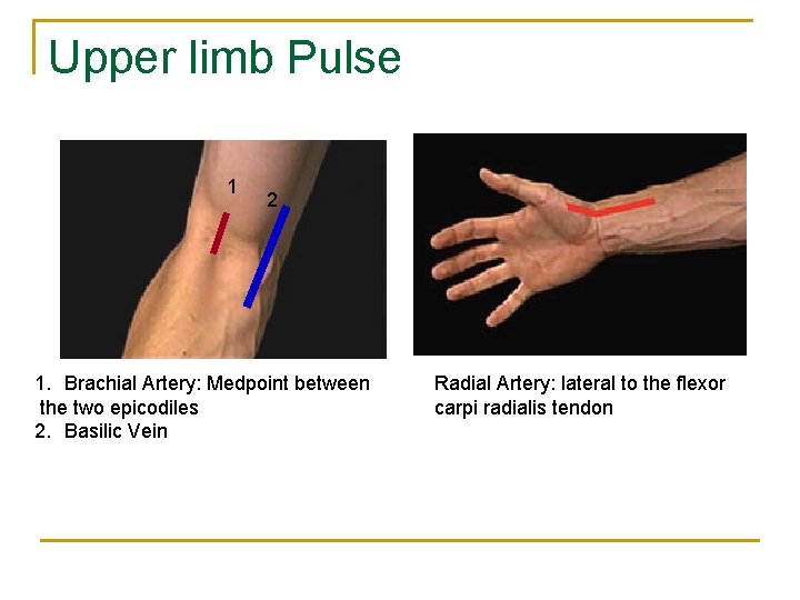 Upper limb Pulse 1 2 1. Brachial Artery: Medpoint between the two epicodiles 2.