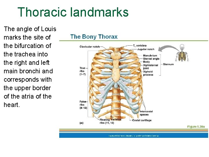 Thoracic landmarks The angle of Louis marks the site of the bifurcation of the