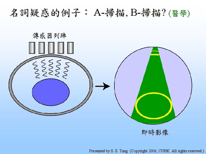 名詞疑惑的例子： A-掃描, B-掃描? (醫學) 傳感器列陣 即時影像 Presented by S. S. Tong (Copyright 2006, CUHK.