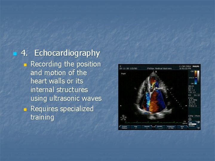 n 4. Echocardiography n n Recording the position and motion of the heart walls