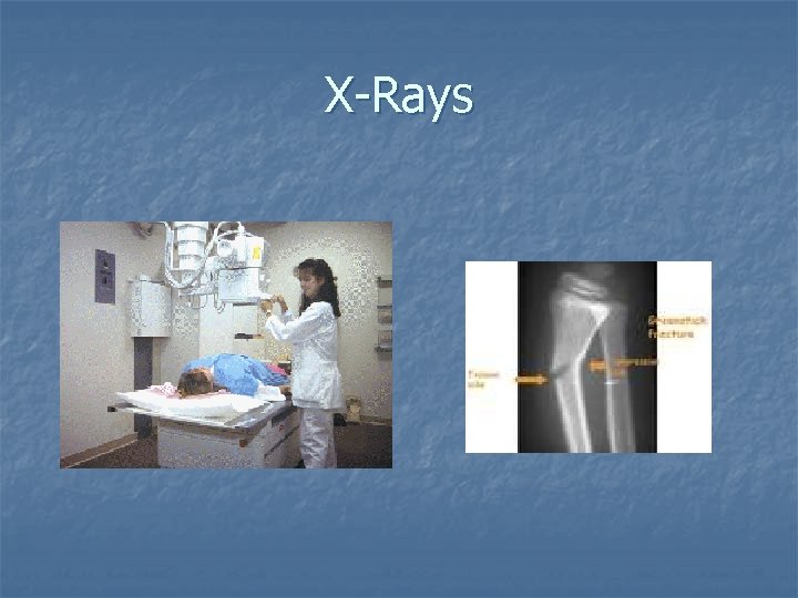X-Rays 