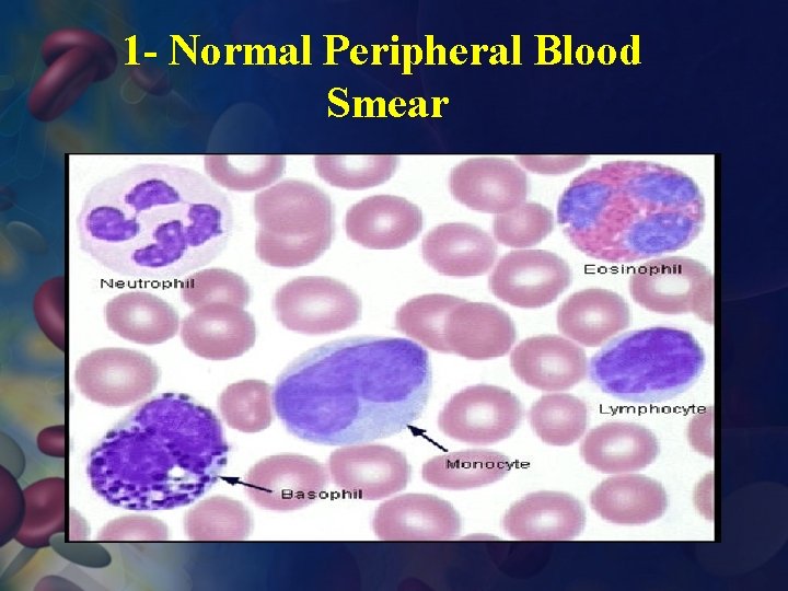 1 - Normal Peripheral Blood Smear 