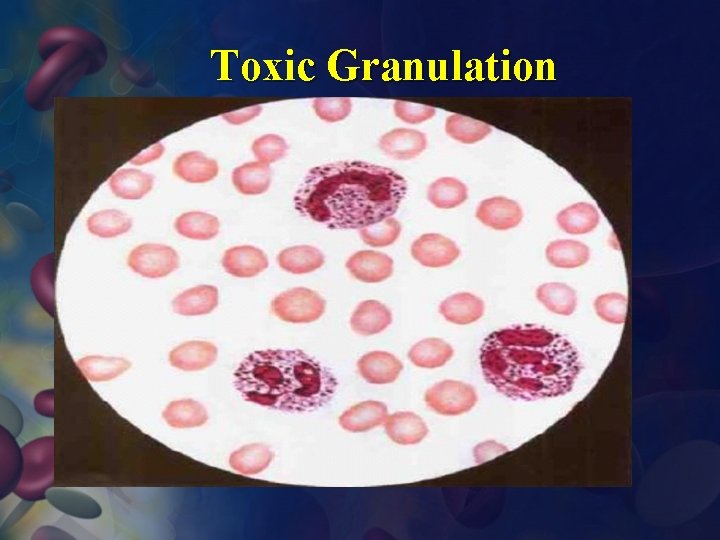 Toxic Granulation 