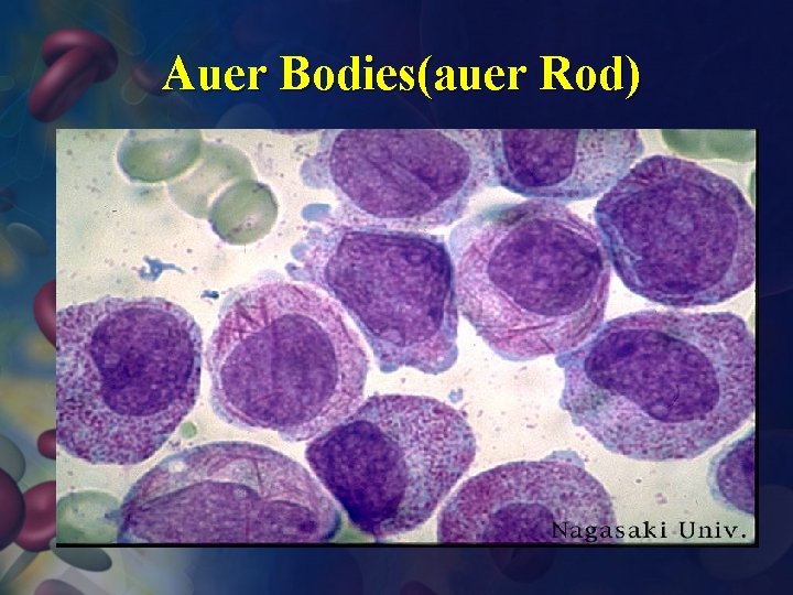 Auer Bodies(auer Rod) 