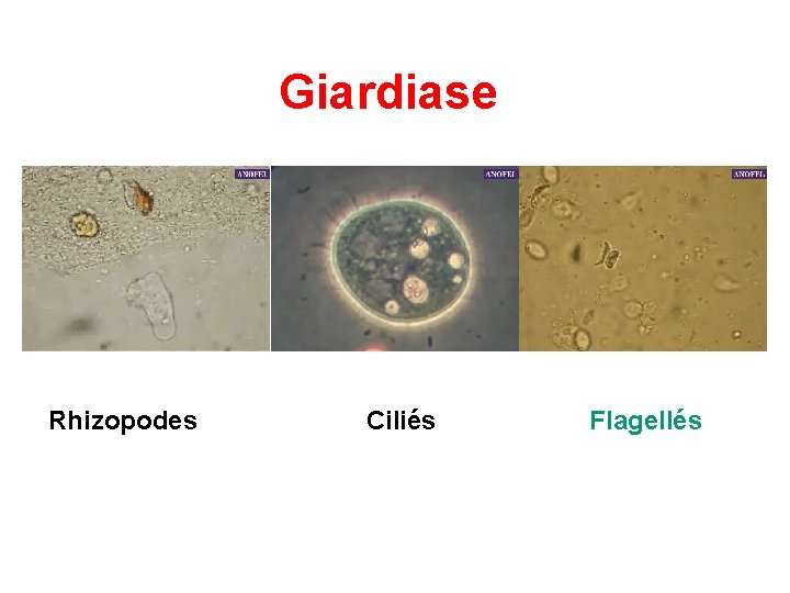 Giardiase Rhizopodes Ciliés Flagellés 