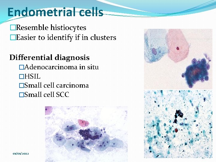 Endometrial cells �Resemble histiocytes �Easier to identify if in clusters Differential diagnosis �Adenocarcinoma in