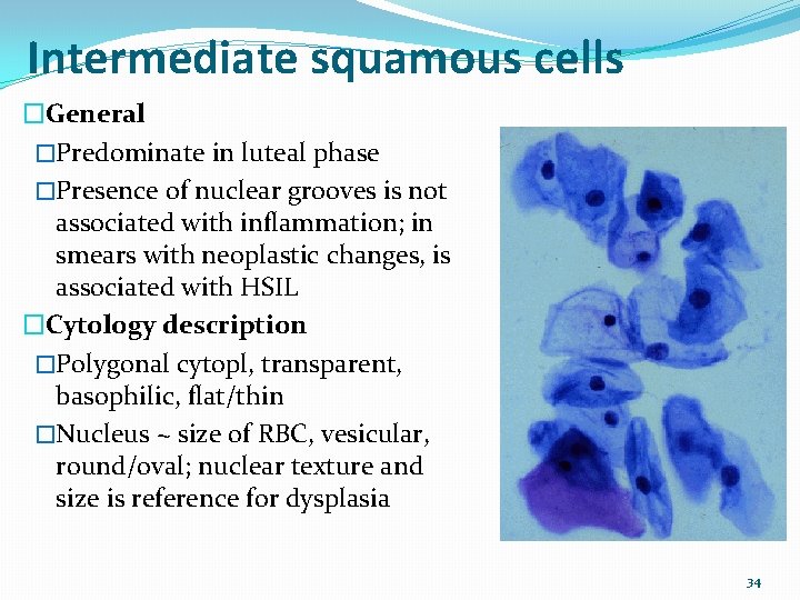 Intermediate squamous cells �General �Predominate in luteal phase �Presence of nuclear grooves is not