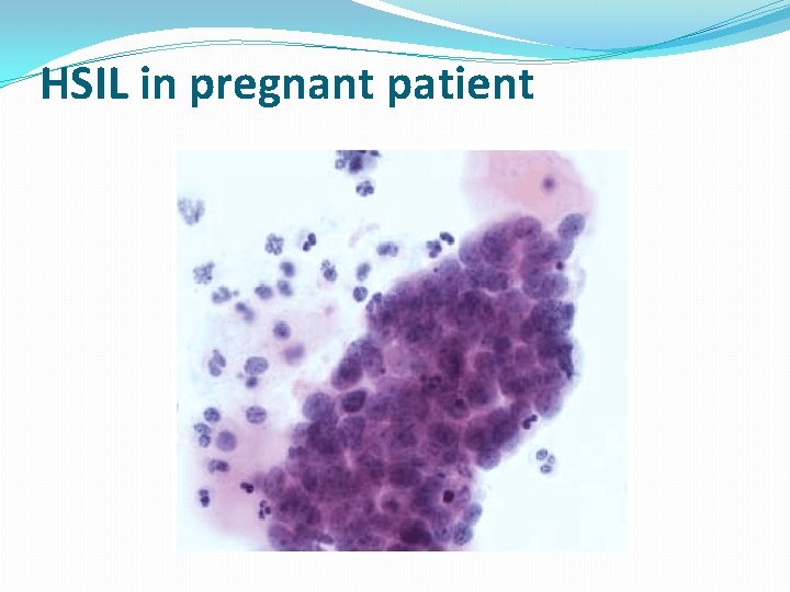 HSIL in pregnant patient 