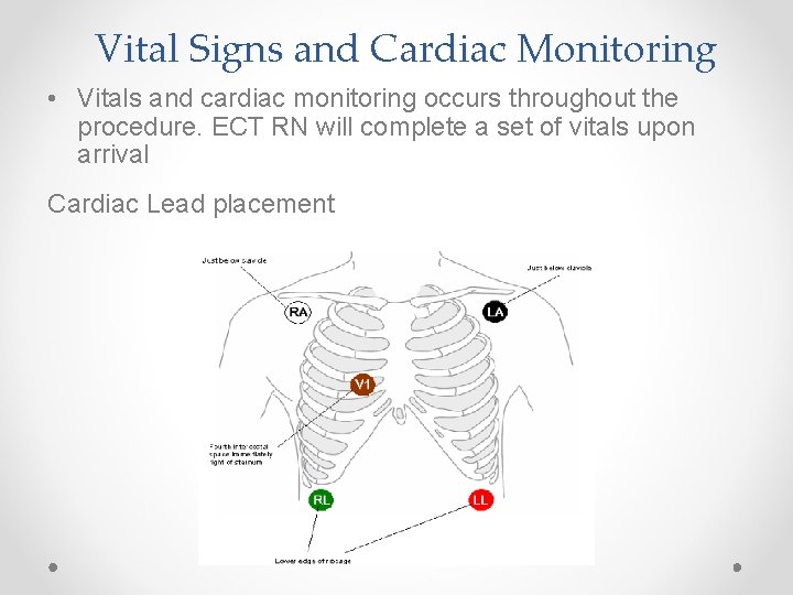 Vital Signs and Cardiac Monitoring • Vitals and cardiac monitoring occurs throughout the procedure.