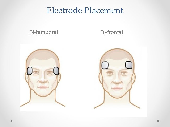 Electrode Placement Bi-temporal Bi-frontal 