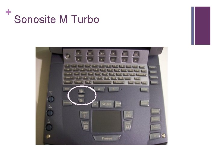 + Sonosite M Turbo 