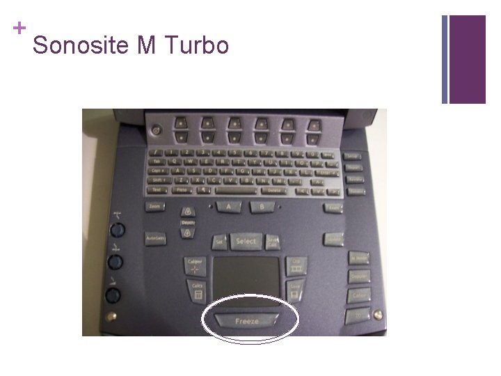 + Sonosite M Turbo 