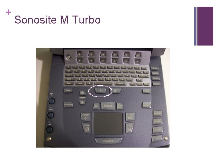 + Sonosite M Turbo 