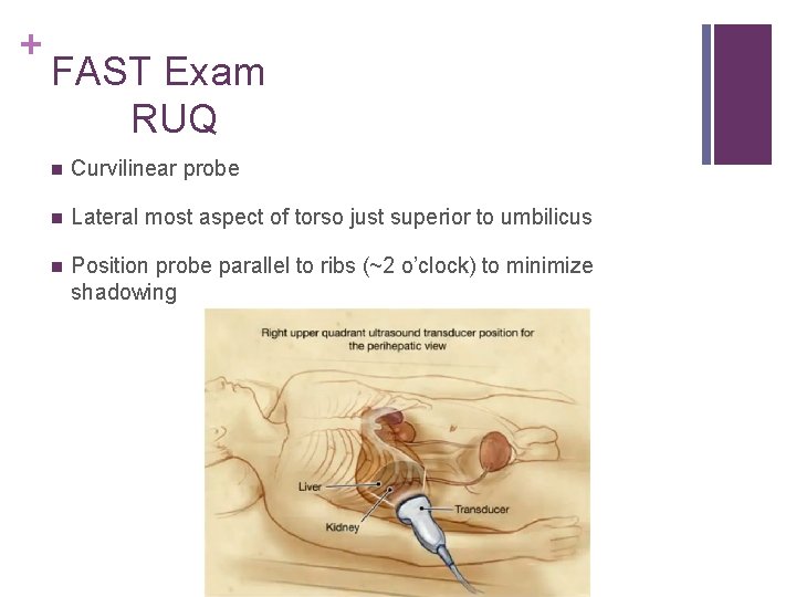 + FAST Exam RUQ n Curvilinear probe n Lateral most aspect of torso just